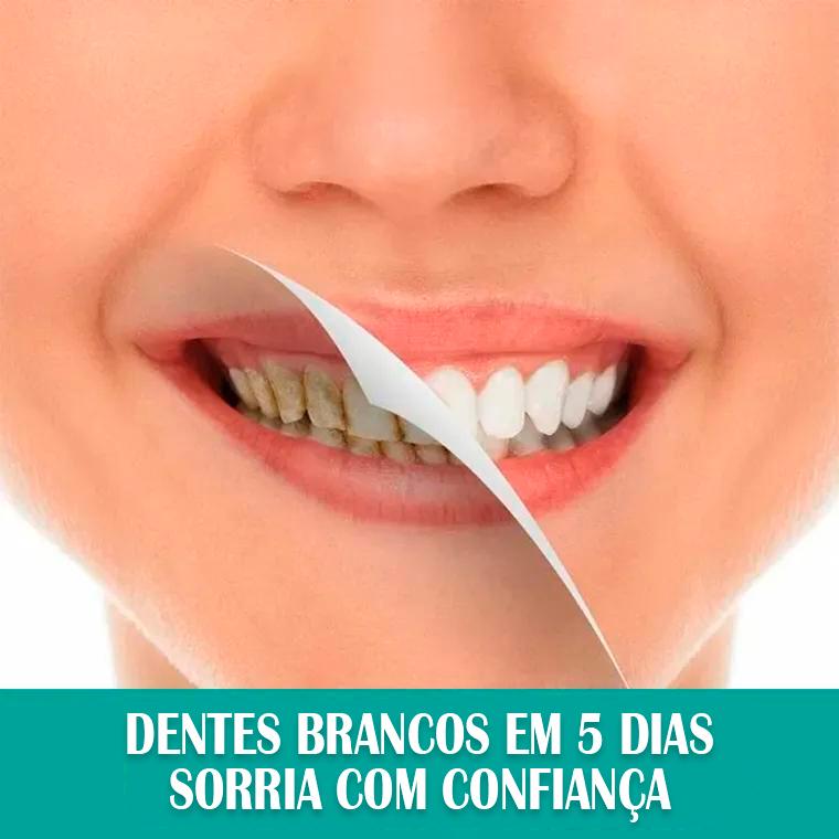 Clareador Dental (Dentes brancos em 5dias🔥)