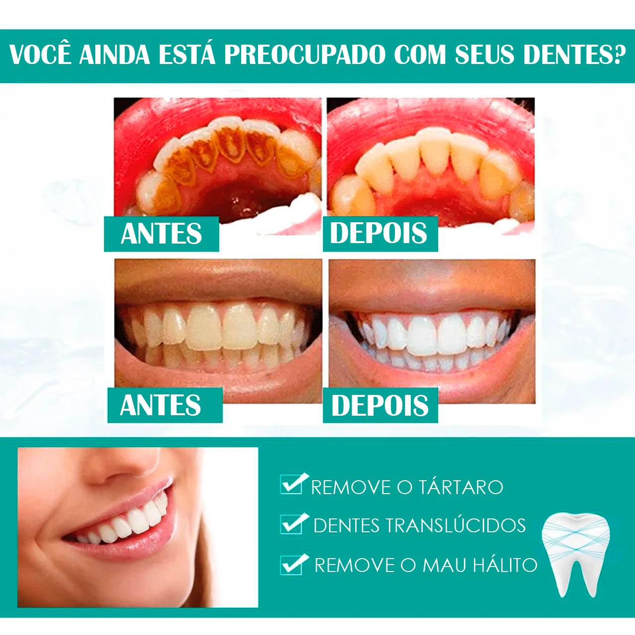 Pó Dental Milagroso😍Dentes Brancos EM 5DIAS🔥