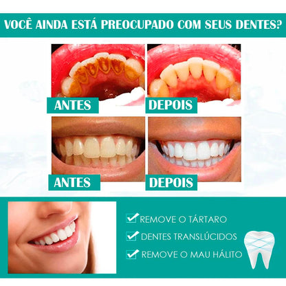 Pó Dental Milagroso😍Dentes Brancos EM 5DIAS🔥