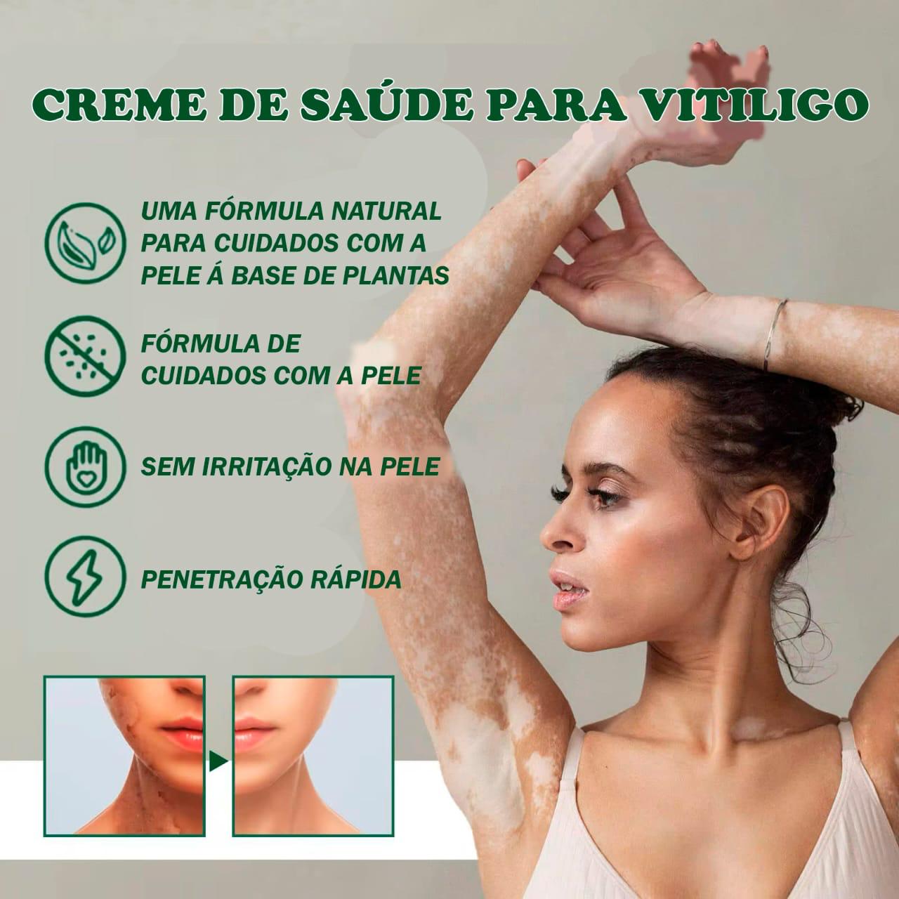 CREME 3 EM 1 (SUA PELE COMO ERA ANTES EM 4 SEMANAS.)
