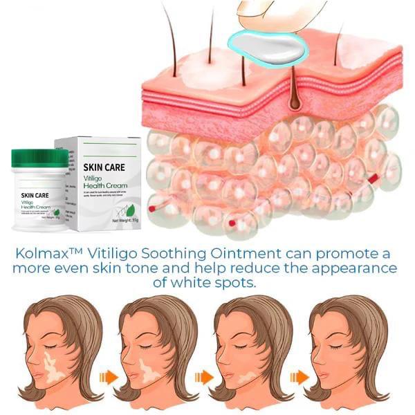 CREME 3 EM 1 (SUA PELE COMO ERA ANTES EM 4 SEMANAS.)