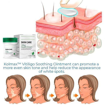 CREME 3 EM 1 (SUA PELE COMO ERA ANTES EM 4 SEMANAS.)