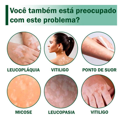 CREME 3 EM 1 (SUA PELE COMO ERA ANTES EM 4 SEMANAS.)