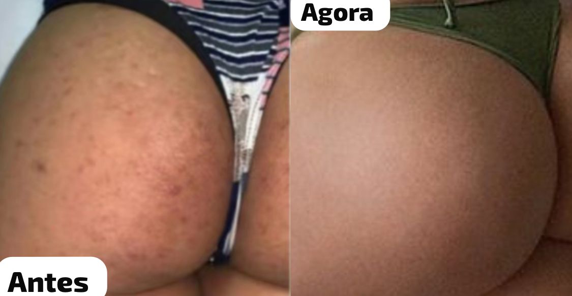 CREME MILAGROSO DA COCONUT 🥥 😍