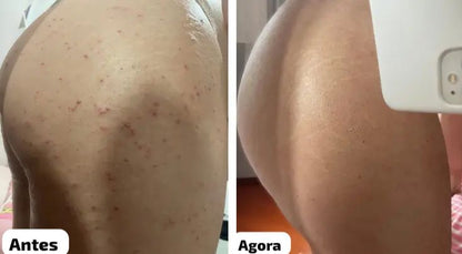 CREME MILAGROSO DA COCONUT 🥥 😍