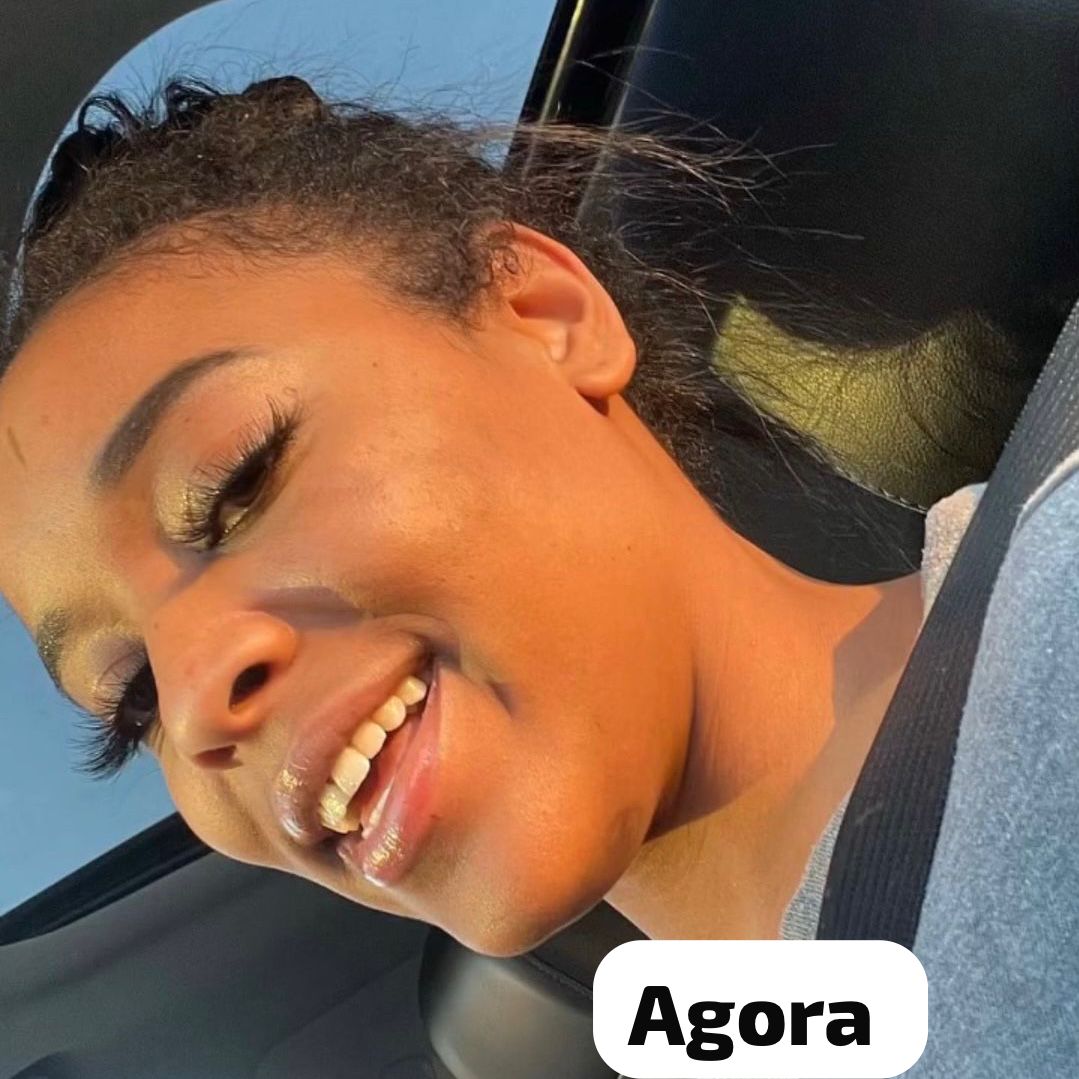 CREME MILAGROSO DA QUICK REPAIR 😍PELE LISA EM 7 DIAS😍