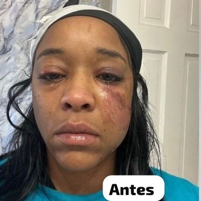 CREME MILAGROSO DA QUICK REPAIR 😍PELE LISA EM 7 DIAS😍