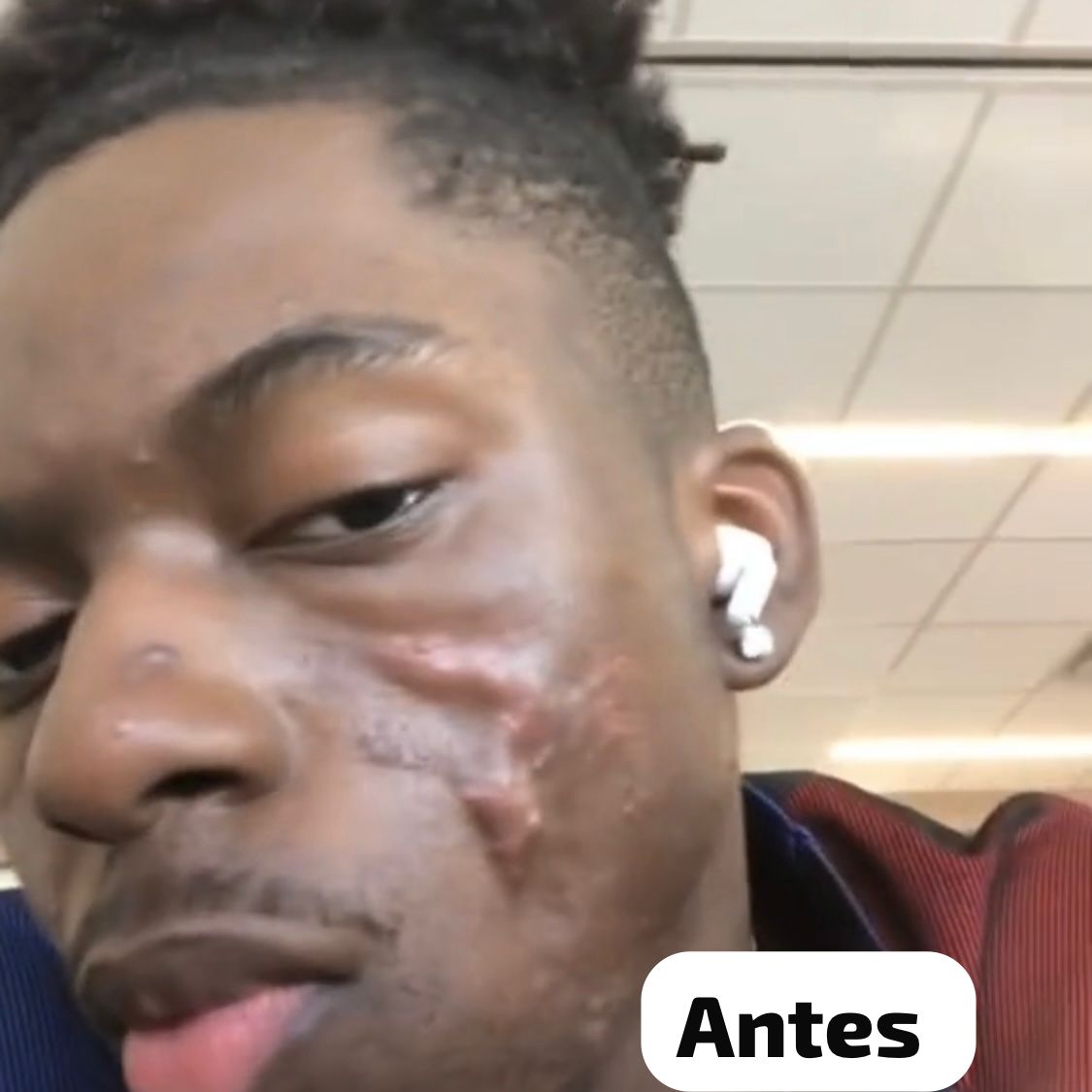 CREME MILAGROSO DA QUICK REPAIR 😍PELE LISA EM 7 DIAS😍