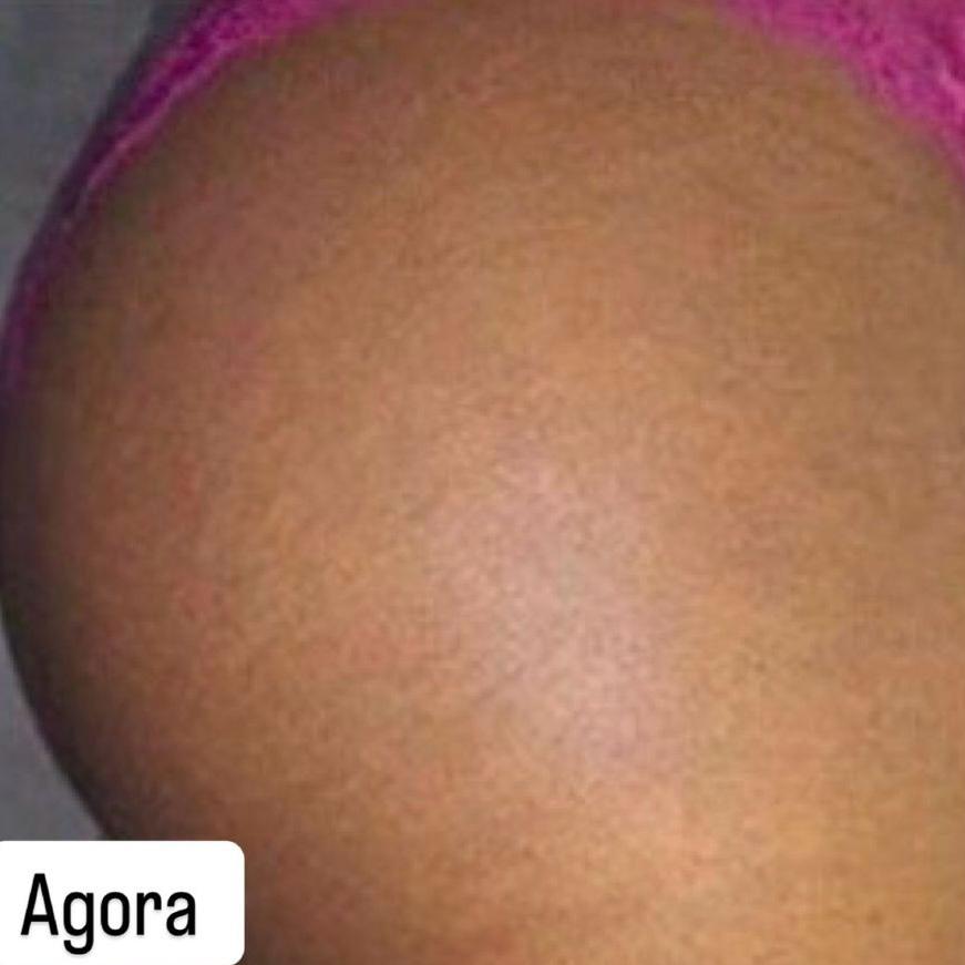 CREME MILAGROSO DA QUICK REPAIR 😍PELE LISA EM 7 DIAS😍