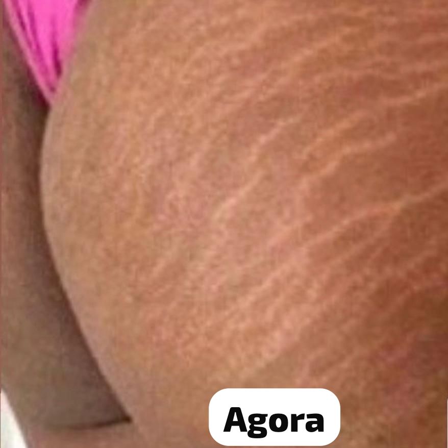 CREME MILAGROSO DA QUICK REPAIR 😍PELE LISA EM 7 DIAS😍