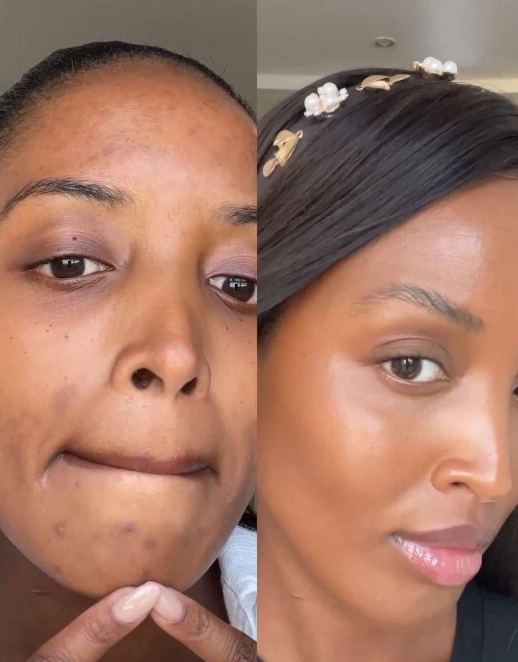 😍Creme Milagroso da coconut 🥥 😍 Pele Lisa em Apenas 7 dias🔥