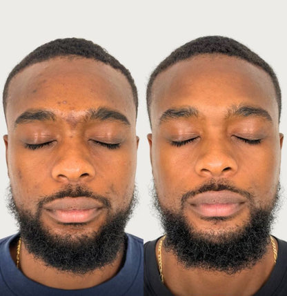 😍Creme Milagroso da coconut 🥥 😍 Pele Lisa em Apenas 7 dias🔥