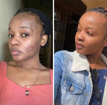 😍Creme Milagroso da coconut 🥥 😍 Pele Lisa em Apenas 7 dias🔥