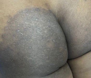 😍Creme Milagroso da coconut 🥥 😍 Pele Lisa em Apenas 7 dias🔥